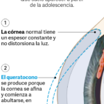 Un médico argentino creó una innovadora técnica para operar una enfermedad de la vista y fue premiado en Italia