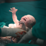 Estudiaron si la inyección epidural para un parto sin dolor puede causar daño neurológico en los bebés